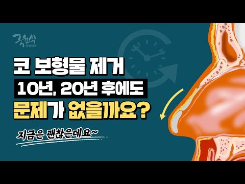 #코보형물제거 후 10년, 20년 지나도 문제 없는 걸까요?