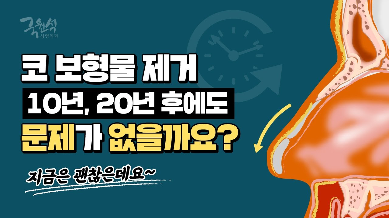 #코보형물제거 후 10년, 20년 지나도 문제 없는 걸까요? 썸네일