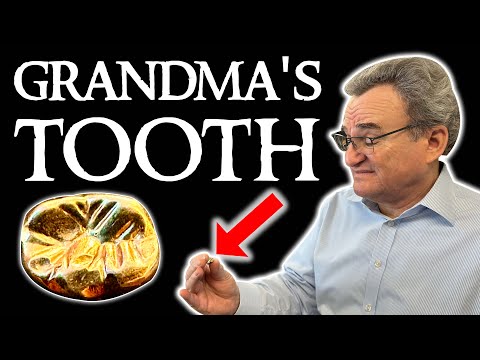 Wie viel ist der Goldzahn meiner Oma wert? Goldbewertung