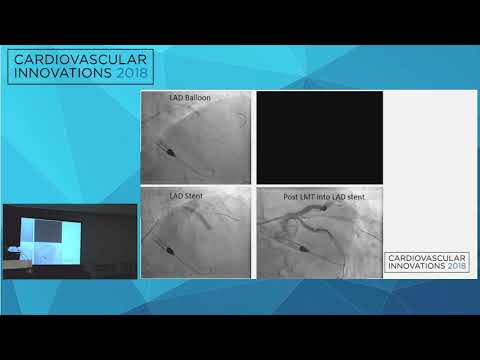 CVI2018 Session: Complex left radial PCI using Impella - Brian Stegman, MD