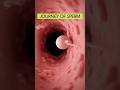 Journey of the SPERM in the vagina ❤️ #anatomy #shorts