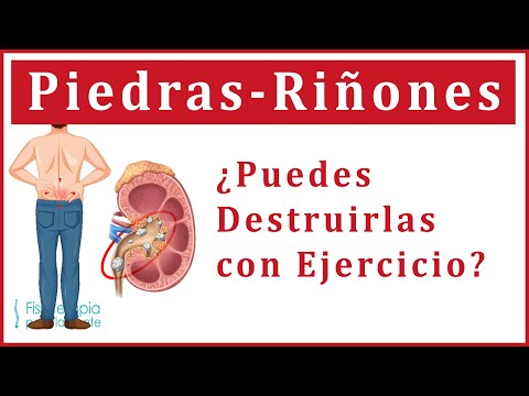❌NO EXISTE EJERCICIO 🛑CUIDADO