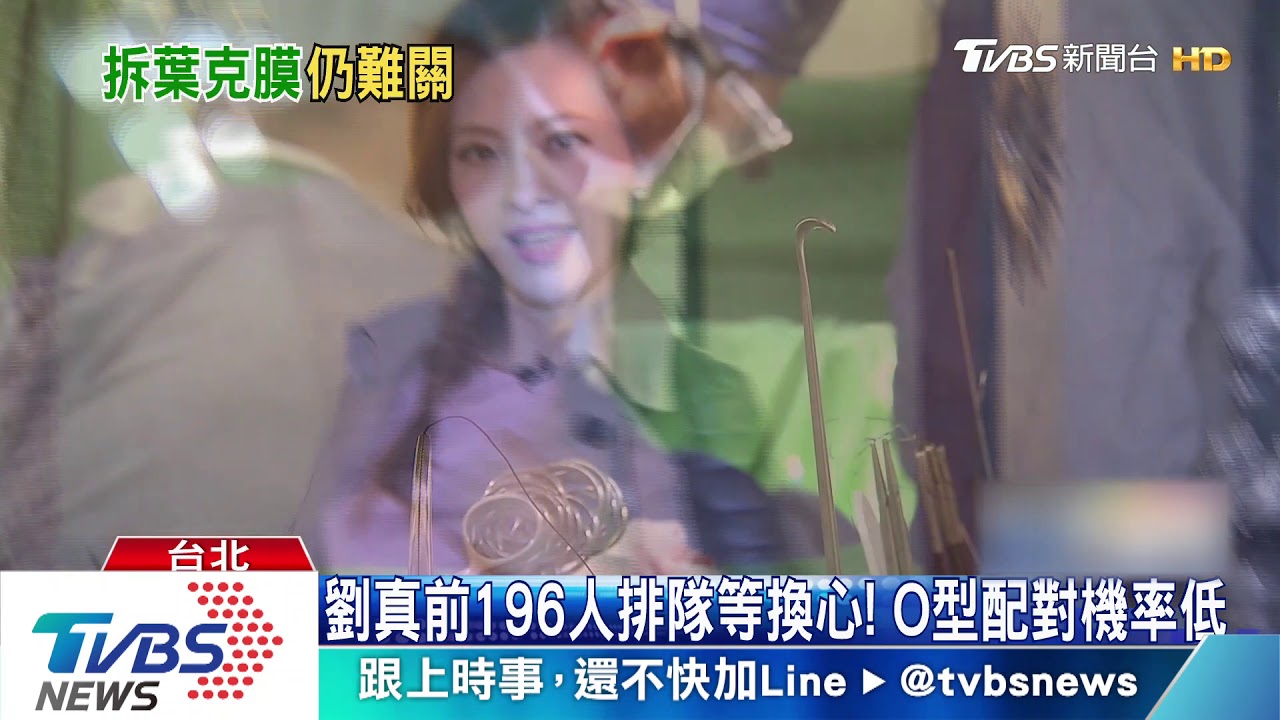 劉真等待心臟移植 裝心室輔助器爭時間