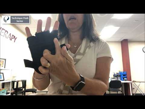 Tired of Trigger Finger? These 3 Splints Help