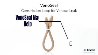 Product video: VenoSeal Venous Leak Constriction Loop 