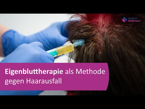 Eigenbluttherapie als Methode gegen Haarausfall – Tanja Czarnotta, Oberärztin / Ästhetik Hellersen