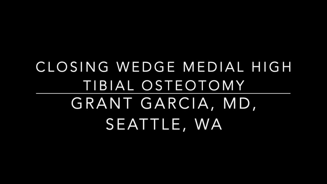 Dr. Garcia demonstrates his technique for a closing wedge high tibial osteotomy