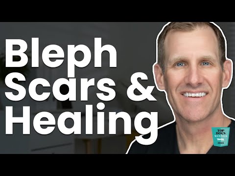 Do Upper Eyelid Blepharoplasty Scars Show? Tips to Minimize Incision Visibility