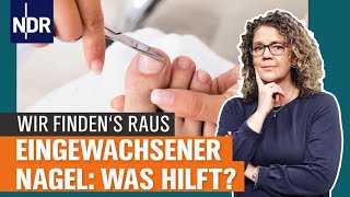 Eingewachsener Zehennagel: Ursachen und richtige Behandlung | Visite | NDR