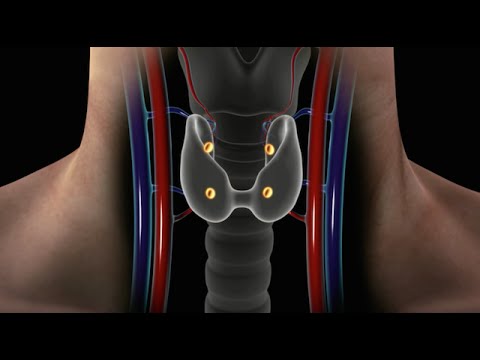 Overview of Parathyroid Disease (Causes, Symptoms and Treatment for Hyperparathyroidism)