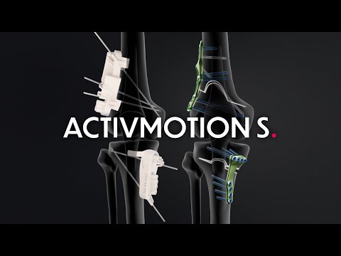 Activmotion S range - Knee alignment