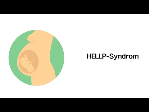 HELLP Syndrom - Erkrankungen in der Schwangerschaft (mit Infoleiste)