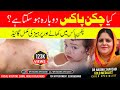 Diet In Chicken Pox Kia Chicken Pox Dobara Ho Skta Hy Urdu Hindi Dr Nagina Shahzadi
