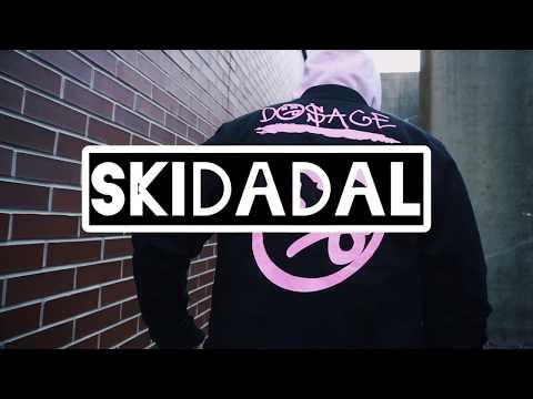 Skidadal- Ain't Playing (Official Music Video)