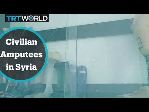 WHO says 86,000 civilians have lost their limbs in Syrian conflict