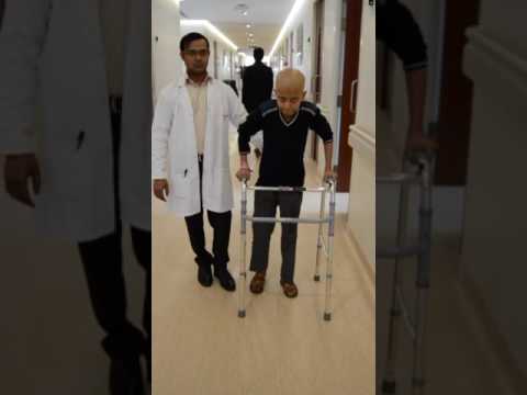 Osteosarcoma In Young Boy With Expandable Custom Made Tumour Prosthesis — Patient Video
