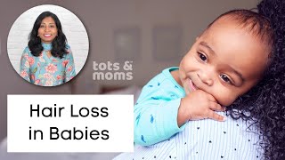 Hair Loss in Babies 👶 | Reasons & Tips to avoid Infant Hair Loss