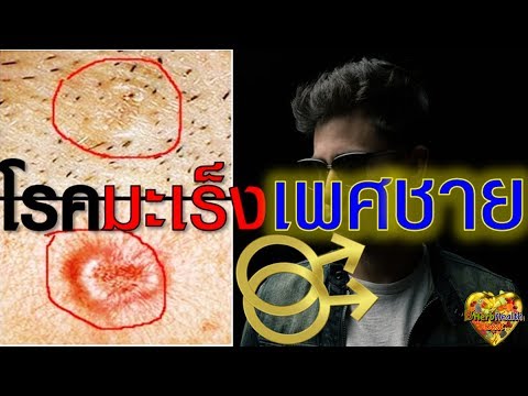ที่ชอบความอ่อนแอ boritsya ความอ่อนแอของโปรตีน