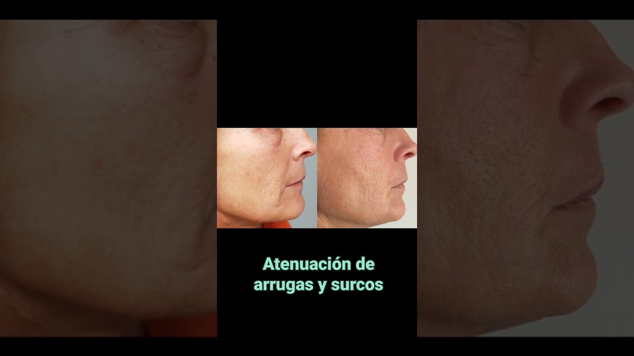 Rosalba Herrero Zerpa-636