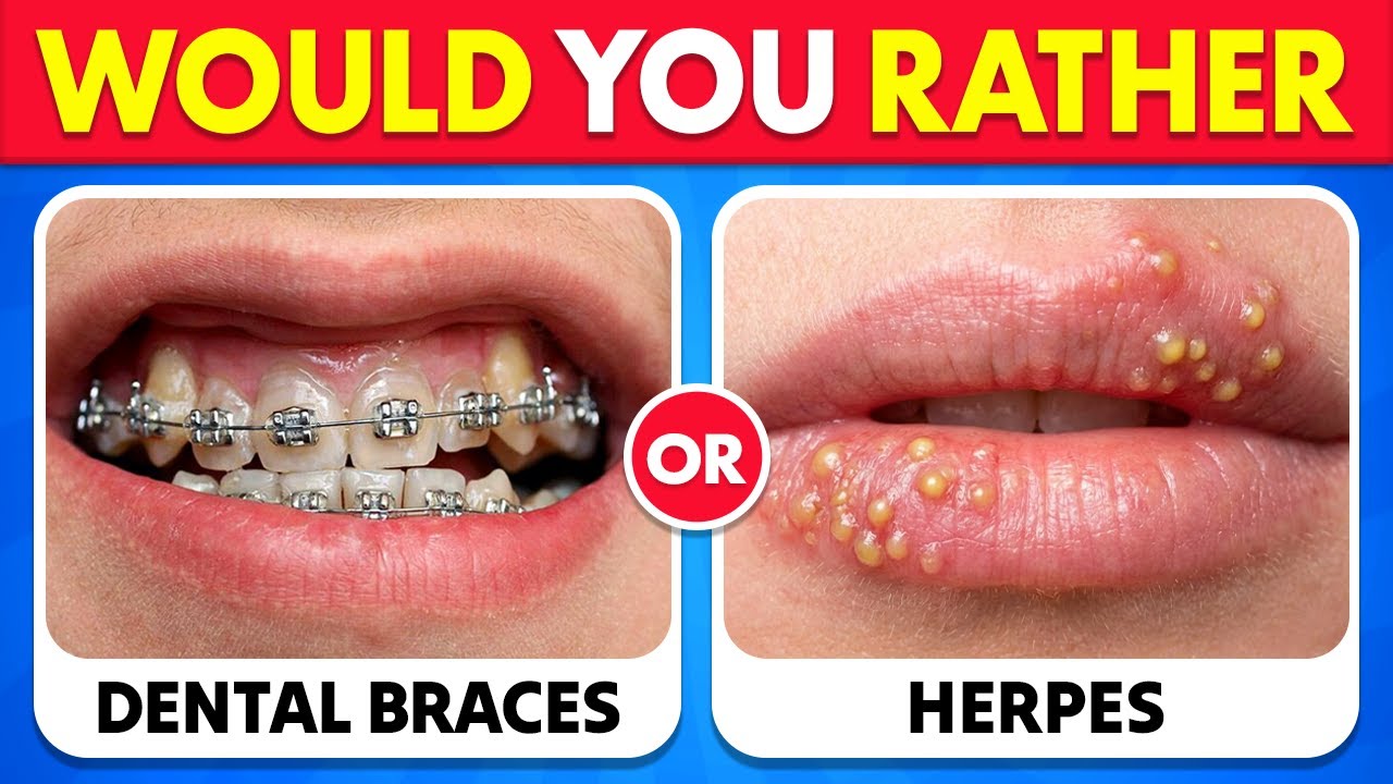 🔥 Would You Rather...? 😨 The 100 Most Extreme Choices You’ll EVER Face!