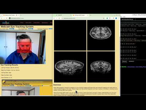 Interactive Brain3D: Volumetric Brain Imaging, Loading Optimization & 3D Rendering Improvements