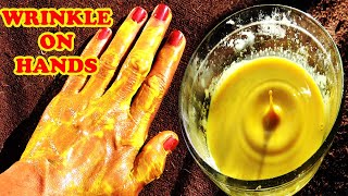 COZ MY HANDS LOOK OLD AND WRINKLED, USING NATURAL REMEDY FOR WRINKLED HANDS