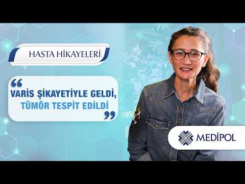 Beklenmedik Tanı: Varis Muayenesinde Kalpte Kitle Ortaya Çıktı!