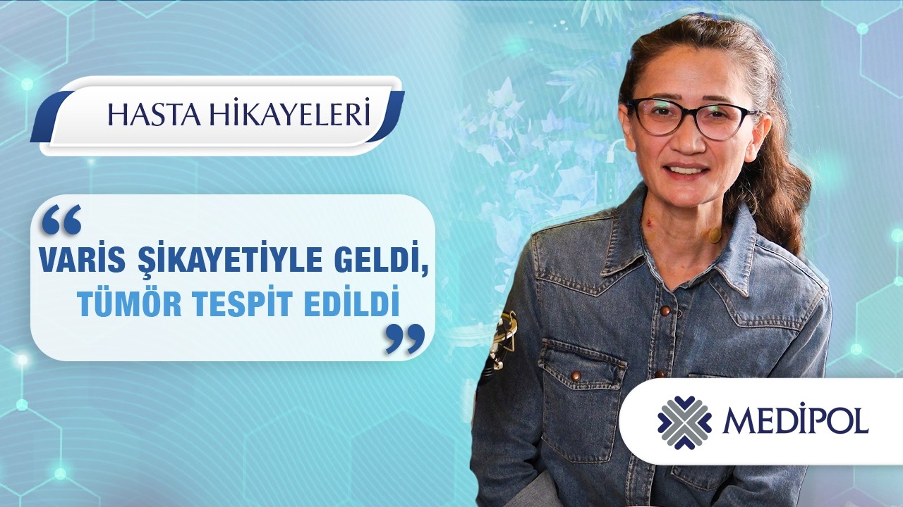 Beklenmedik Tanı: Varis Muayenesinde Kalpte Kitle Ortaya Çıktı!