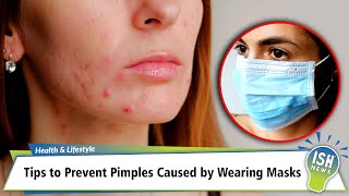 Tips to Prevent Pimples Caused by Wearing Masks