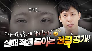 쌍수 실패율 70%? 성형외과 전문의가 말하는 실패 확률 줄이는 방법