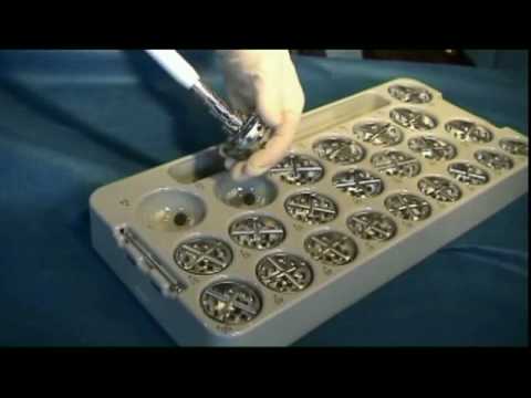 Wie die Videoverbindungen wiederherstellen Luxation der Knie Rehabilitation