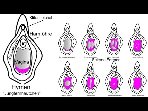 Nach dem Sex zog stark Unterbauch warum Wie ist Geld und Sex