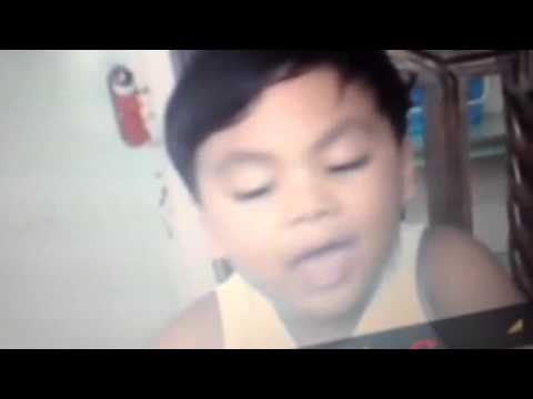 Pagsasabwatan upang yodo mula kuko halamang-singaw Kuko pagkulangin para sa paggamot ng mga fractures