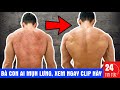 Bà con ai bị MỤN phải xem ngay clip này ✅ - Hướng dẫn trị mụn lưng tại nhà 👍