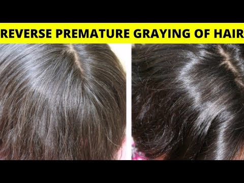 , title : 'How To Reverse Premature Graying Of Hair Naturally'