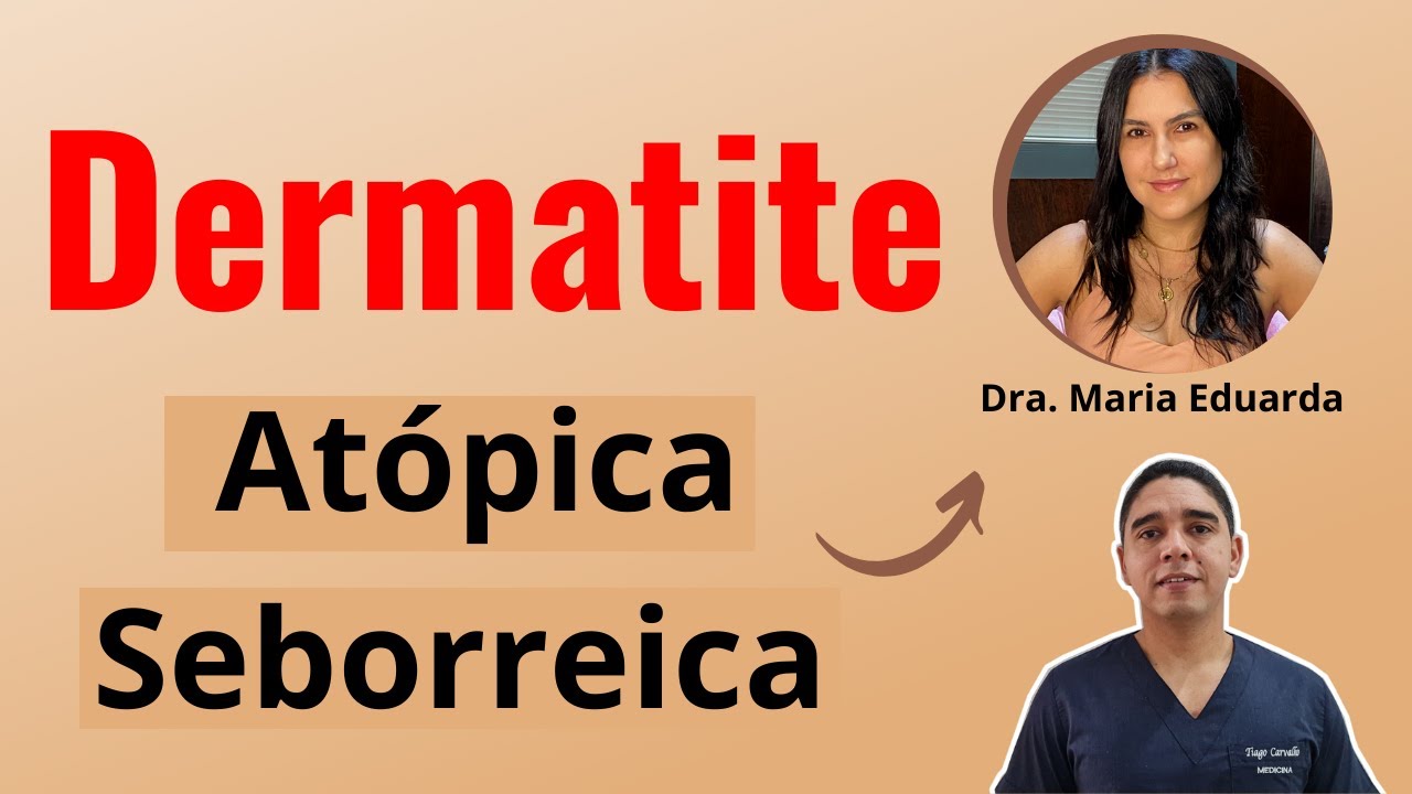 Dermatite Atópica e Dermatite Seborreica