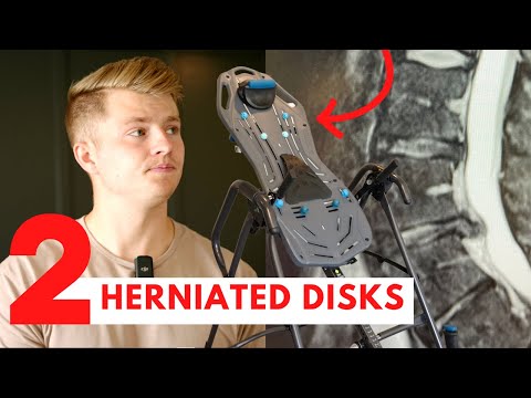 My Honest Review | Teeter FitSpine X3 Inversion table