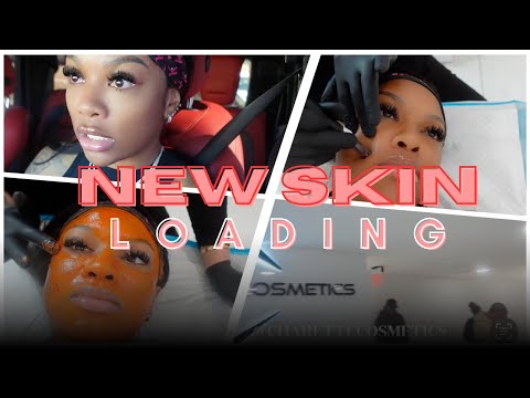 COME GET A CHEMICAL PEEL AND SPEND A DAY WITH ME 1 ONE