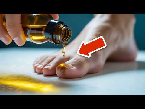 Use THIS to remove nail fungus and athlete's foot 💥 (Incredibly fast) 🤯
