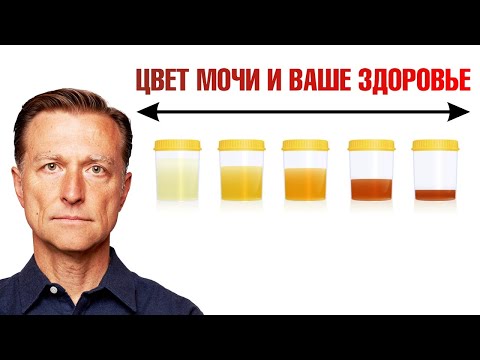 О чем говорит цвет мочи? Цвет мочи как индикатор здоровья🙌