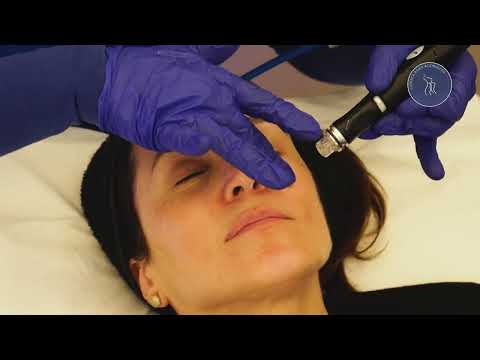 Tratamiento con Hydrafacial