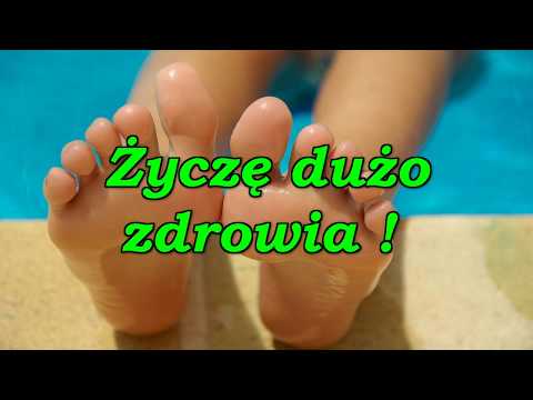 Guzki w palucha Kości na dużym chirurgii toe wideo