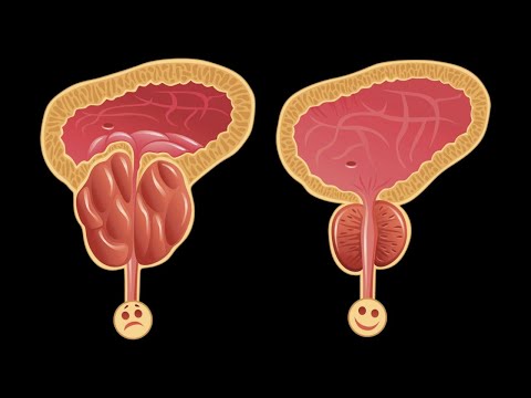💪 Drink 1 CUP A DAY to reduce an enlarged prostate.