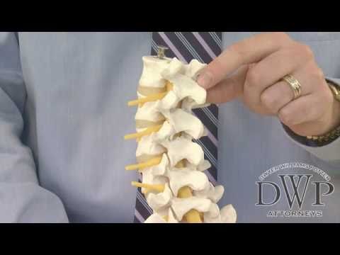 Anatomy of the Spine and Introduction to Spinal Cord Injuries