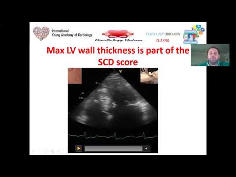 Episode 12:  Echo in HOCM