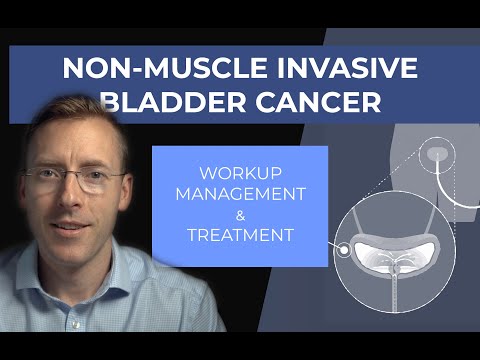 Management of Non-Muscle Invasive Bladder Cancer