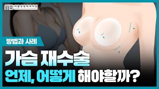 실제 사례로 본 가슴 재수술, 무엇이 문제였을까⁉