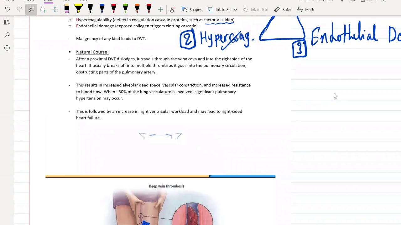 4. Pulmonology part 4 for USMLE Step 2 CK - (Free trial course in Description Below)