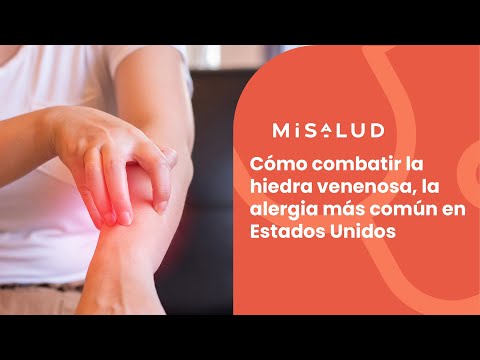 Cómo combatir la hiedra venenosa, la alergia más común en Estados Unidos | MiSalud