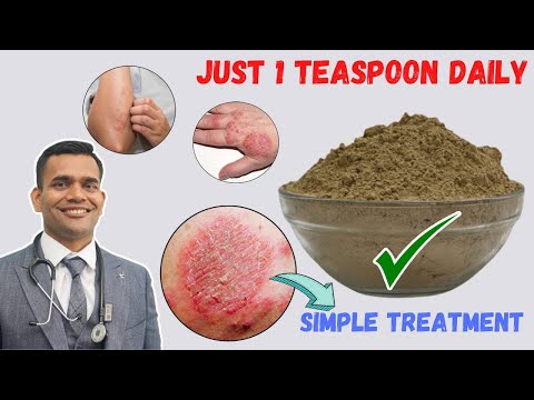 Just 1 Teaspoon Daily To Cure all Your Skin Problems | Eczema - Simple Treatment